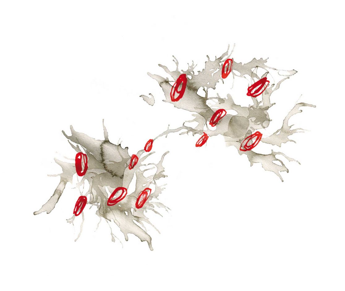 5e_geniale-reizverarbeitung_illu